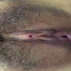 เงี่ยนมากจนน้ำแตก ทำยังไงถึงจะหาย