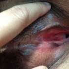 หีแบบนี้จะเรียกว่ายังไง คะ