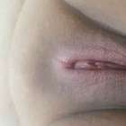 หลังโกน