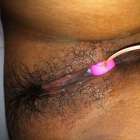 มันจะไหลย้อนหน่อยๆ 