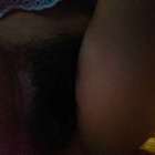 ขนเยอะโกนให้หน่อย