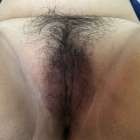 Before and After โกนหรือไม่โกนหีดี