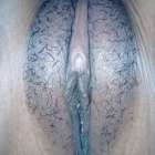 มันเพล็บเลย