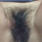 ก่อน-หลังโกน