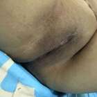 หีเมีย V.6