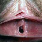 หีคนไม่เคยมีแฟน ส่วนมากเหม็น และ ตกขาวเยอะ จริงมั้ย?