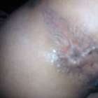 รูตูดและบั้นท้าย