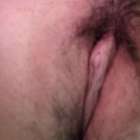 เม็ดแตดหนูดูใหญ่ น่าเกลียดมากมั้ยคะ กังวล 