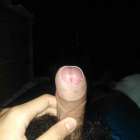 อายุ17​ หมอยเยอะไปไหมครับ