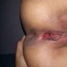 ถ้าผ่านค่อยลงเพิ่ม